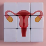 Beyond the Ovaries: The Paradigm Shift from PCOS to PMOS