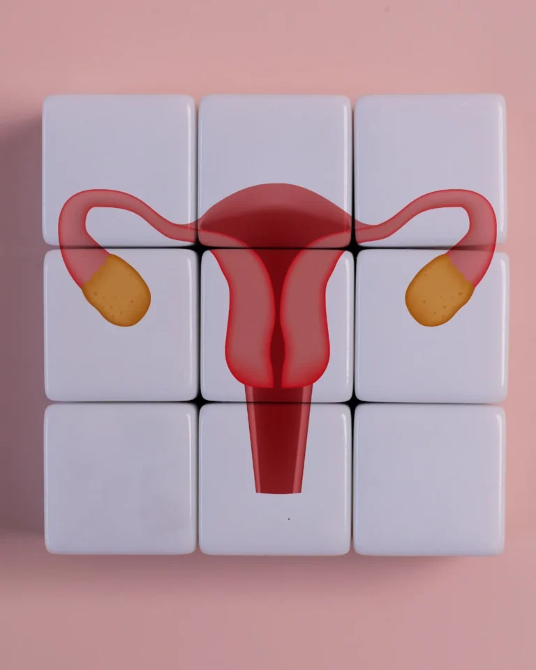 Beyond the Ovaries: The Paradigm Shift from PCOS to PMOS
