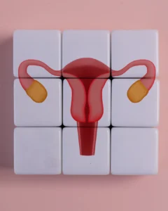 Beyond the Ovaries: The Paradigm Shift from PCOS to PMOS