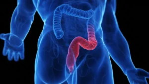 Beyond Weight Loss: GLP-1 Receptor Agonists Show Potential in Treating Ulcerative Colitis