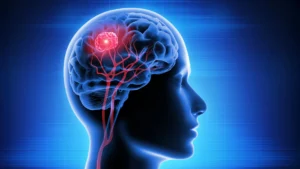 Bridging the Blood-Brain Barrier: A Vitamin B12-Based Breakthrough in Glioblastoma Treatment