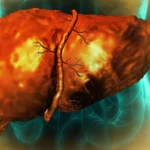 Cellular Limbo: Why Alcohol-Damaged Livers Fail to Heal