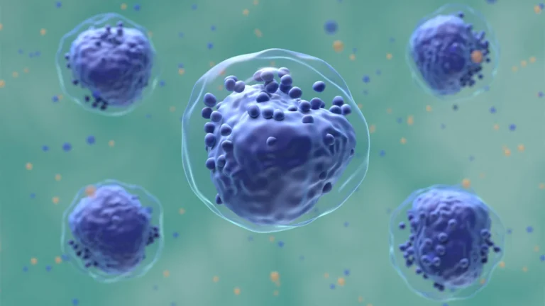 Clinical Trial Setback: Liposomal Chemotherapy Fails to Surpass Standard Care in Pediatric AML