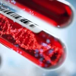 Decoding the Blueprint of Blood Cancer: How Genomic "Family Trees" Are Transforming Clinical Care