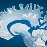 Decoding the Night: How AI-Driven Sleep Analysis Is Revolutionizing Early Alzheimer’s Detection
