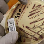 Multi-State Food Poisoning Outbreak Linked to Alfalfa Sprouts: A Growing Public Health Crisis