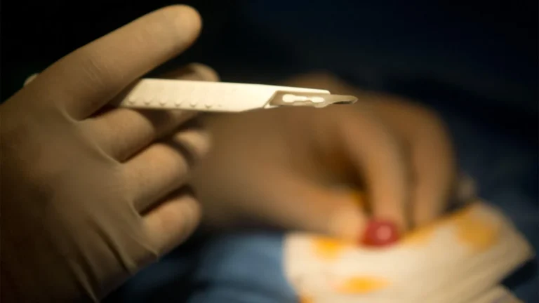New Research Debunks Link Between Neonatal Circumcision and Autism Spectrum Disorder
