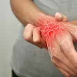 Novel Natural Compound Obakulactone Shows Promise in Remodeling Rheumatoid Arthritis Treatment