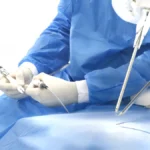 Pioneering Precision: MMI’s Symani Robot Enters New Frontier in Alzheimer’s Research