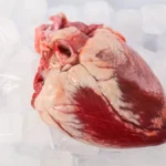 Rethinking Cold: Does Warmer Preservation Lead to Better Heart Transplant Outcomes?