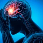 Rethinking the Silent Killer: Breakthrough Study Challenges Assumptions on Lacunar Strokes