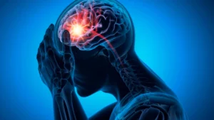 Rethinking the Silent Killer: Breakthrough Study Challenges Assumptions on Lacunar Strokes