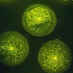 Silent Epidemic: New Data Reveals Valley Fever as a Leading Driver of Hospitalized Pneumonia