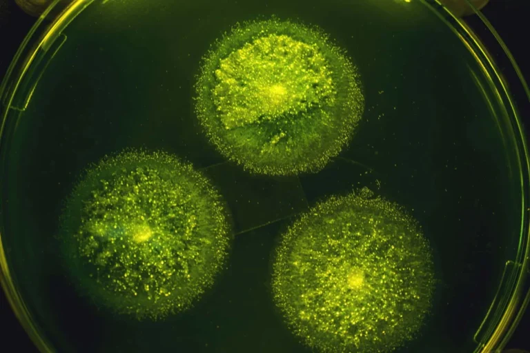 Silent Epidemic: New Data Reveals Valley Fever as a Leading Driver of Hospitalized Pneumonia