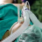 Sustaining Patient Safety: How St. Joseph’s University Medical Center Conquered Unplanned Extubation