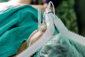 Sustaining Patient Safety: How St. Joseph’s University Medical Center Conquered Unplanned Extubation