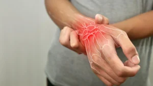 Targeting the Root: How Obakulactone Rewires Cellular Metabolism to Combat Rheumatoid Arthritis