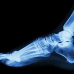 Teledyne’s Strategic Expansion: The Acquisition of Varex Imaging Signals a New Era in MedTech