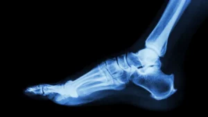 Teledyne’s Strategic Expansion: The Acquisition of Varex Imaging Signals a New Era in MedTech