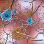 The Blood-Based Revolution: How New Diagnostics Are Transforming Alzheimer’s Care