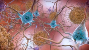 The Dawn of a New Era: The Rapid Expansion of Blood-Based Alzheimer’s Diagnostics
