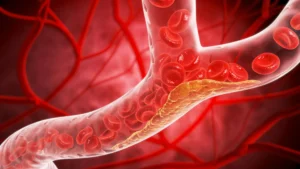 The Dawn of an Oral Revolution: New Pill ‘Enlicitide’ Could Transform Cardiovascular Care