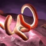 The Fiber Factor: Why Intestinal Parasites Need a High-Fiber Diet to Combat Inflammation