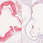 The Genetic "Dial": UT Southwestern Researchers Uncover Novel Protein Regulator for Cholesterol and Liver Health