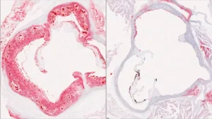 The Genetic Rheostat: UT Southwestern Researchers Uncover Novel Protein Regulating Cholesterol Production