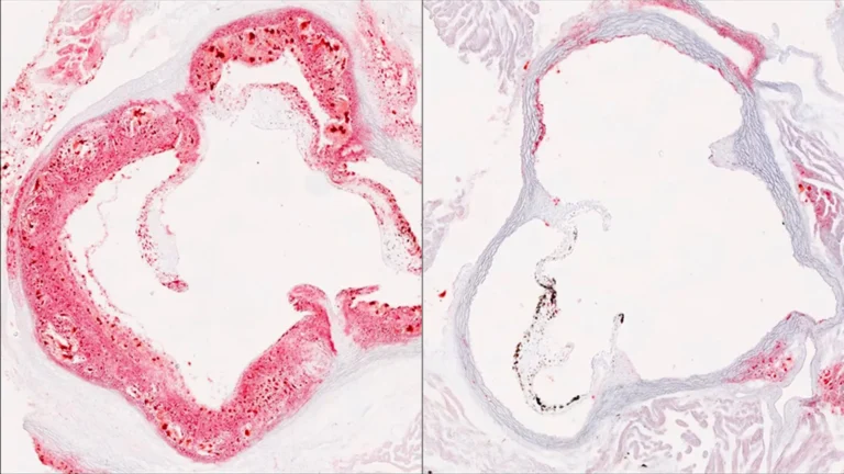 The Genetic Rheostat: UT Southwestern Researchers Uncover Novel Protein Regulating Cholesterol Production