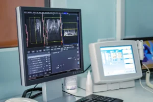 The Global Imperative: Bridging the Gap in Lung Cancer Detection and Equitable Care
