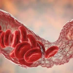 The Hidden Cost of COVID-19: New Research Links Infection to Accelerated Vascular Aging