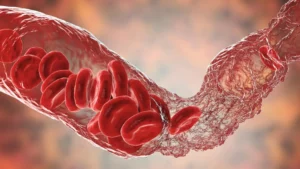 The Hidden Cost of COVID-19: New Research Links Infection to Accelerated Vascular Aging