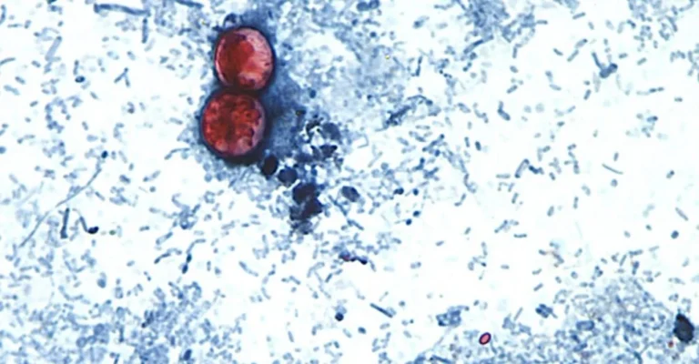 The Hidden Cycle: How Sewage Contamination is Fueling a Record-Breaking Cyclospora Outbreak