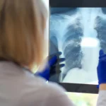 The Hidden Struggle: How Dysfunctional Breathing Compounds the Burden of Chronic Fatigue Syndrome