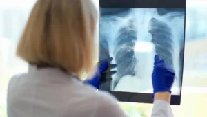 The Hidden Struggle: How Dysfunctional Breathing Compounds the Burden of Chronic Fatigue Syndrome