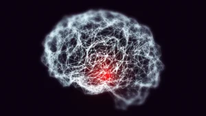 The Iron Link: Unlocking the Biological Connection Between Down Syndrome and Early-Onset Alzheimer’s