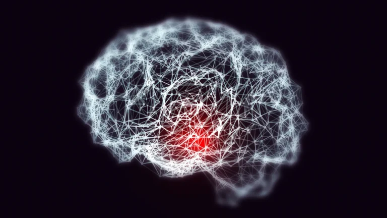 The Iron Link: Unlocking the Biological Connection Between Down Syndrome and Early-Onset Alzheimer’s