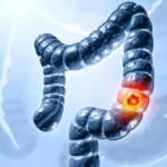 The Key to the Gate: Scientists Uncover the Mechanism Behind a Potent Gut Toxin and Its Link to Colon Cancer