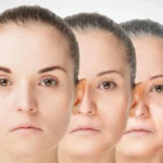 The Malleability of Aging: How Calorie Restriction Reveals a Path to Healthier Longevity
