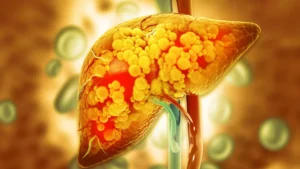 The Metabolic Edge: How Ketogenic Diets Outperform Traditional Approaches in Reversing Prediabetes