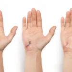 The "Microscope in a Bandage": How AI and Bioelectronics are Revolutionizing Wound Care