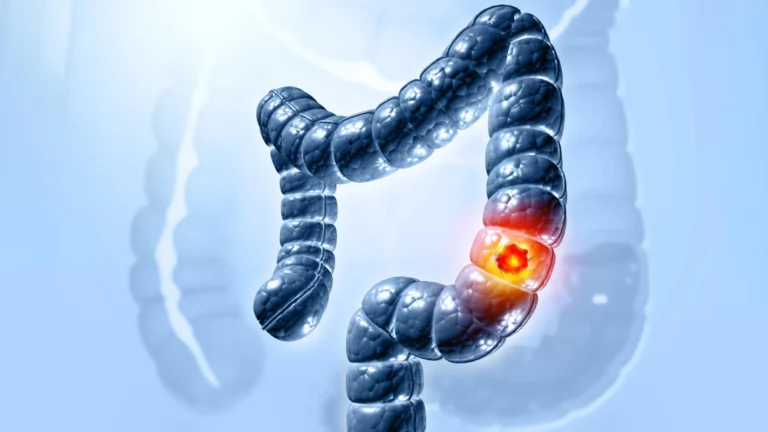 The Missing Link: Scientists Unravel the Mystery of a Deadly Gut Toxin’s Mechanism
