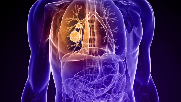 The New Frontier in Precision Oncology: Zipalertinib and the Race to Redefine EGFR Exon 20 Lung Cancer Treatment