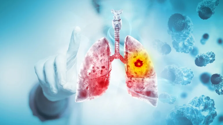 The Paradox of Prevention: New Research Investigates Potential Link Between "Healthy" Diets and Young-Onset Lung Cancer