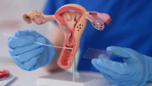 The Silent Crisis: Why Cervical Cancer Screening Rates Are Plummeting in the U.S.