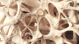 The Silent Epidemic: Understanding and Managing Osteopenia for Lifelong Bone Health