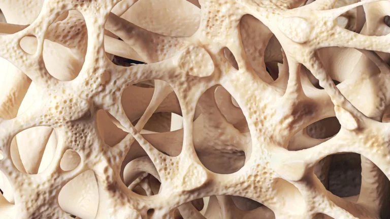 The Silent Epidemic: Understanding and Managing Osteopenia for Lifelong Bone Health