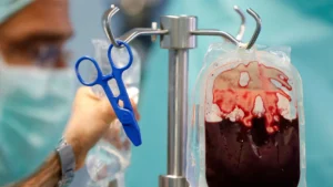 The Silent Seed: Investigating the Potential Risks of Amyloid-Beta Transmission in Blood Transfusions