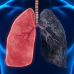 The Unclear Horizon: Investigating the Potential Cancer Risks of Marijuana Use
